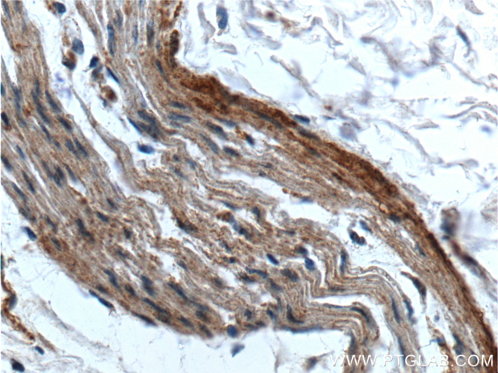 Immunohistochemistry (IHC) staining of human stomach tissue using LIPF Polyclonal antibody (25889-1-AP)