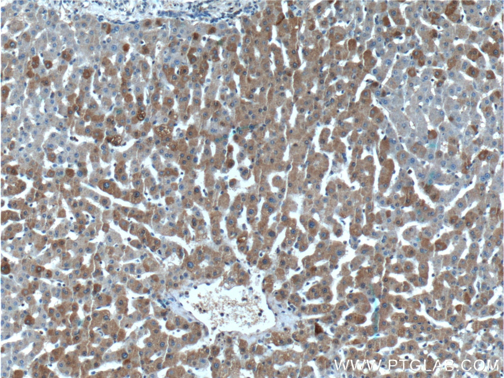 Immunohistochemistry (IHC) staining of human liver tissue using LIPF Polyclonal antibody (25889-1-AP)
