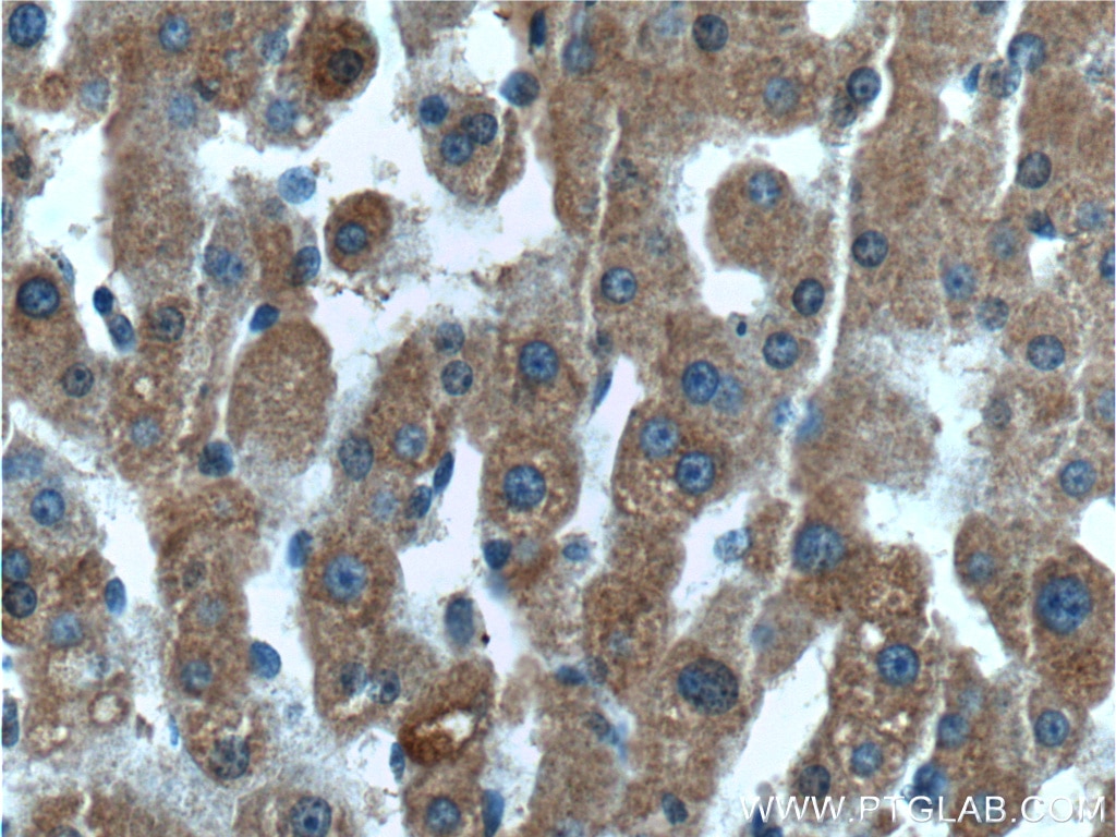 Immunohistochemistry (IHC) staining of human liver tissue using LIPF Polyclonal antibody (25889-1-AP)