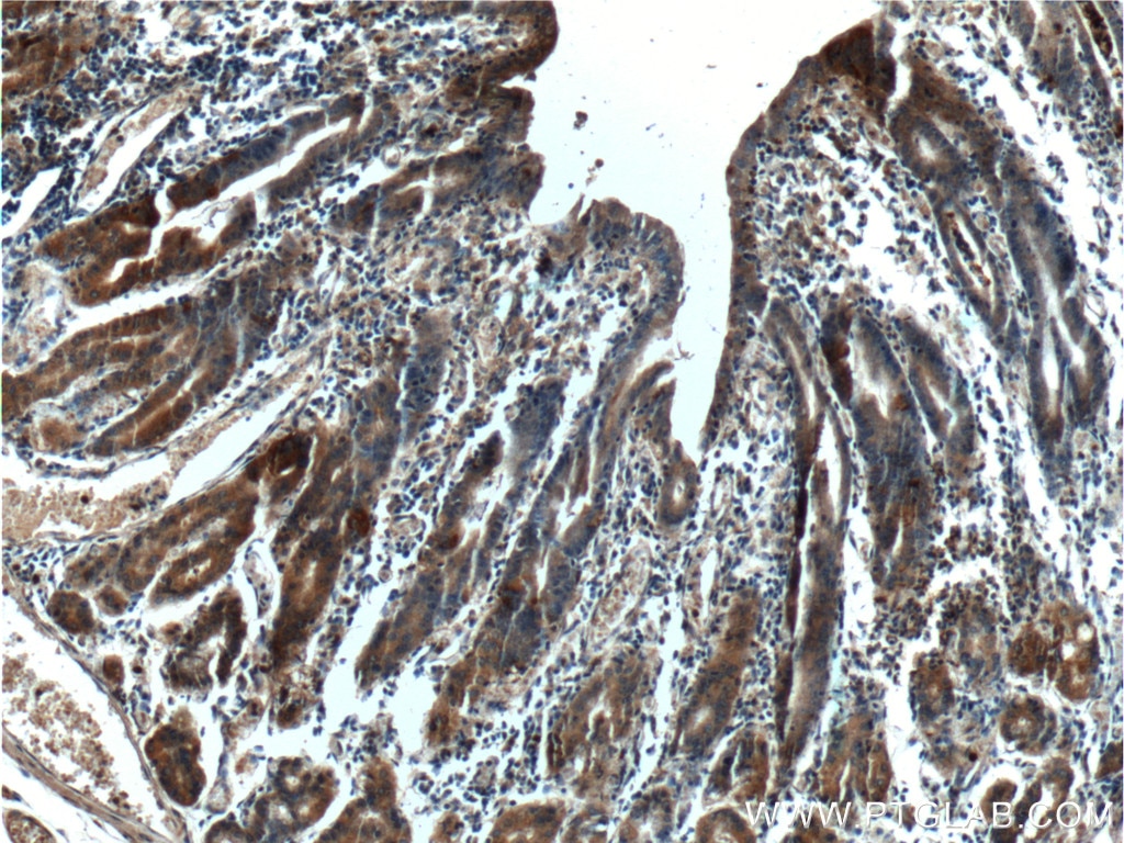 IHC staining of human stomach using 25889-1-AP