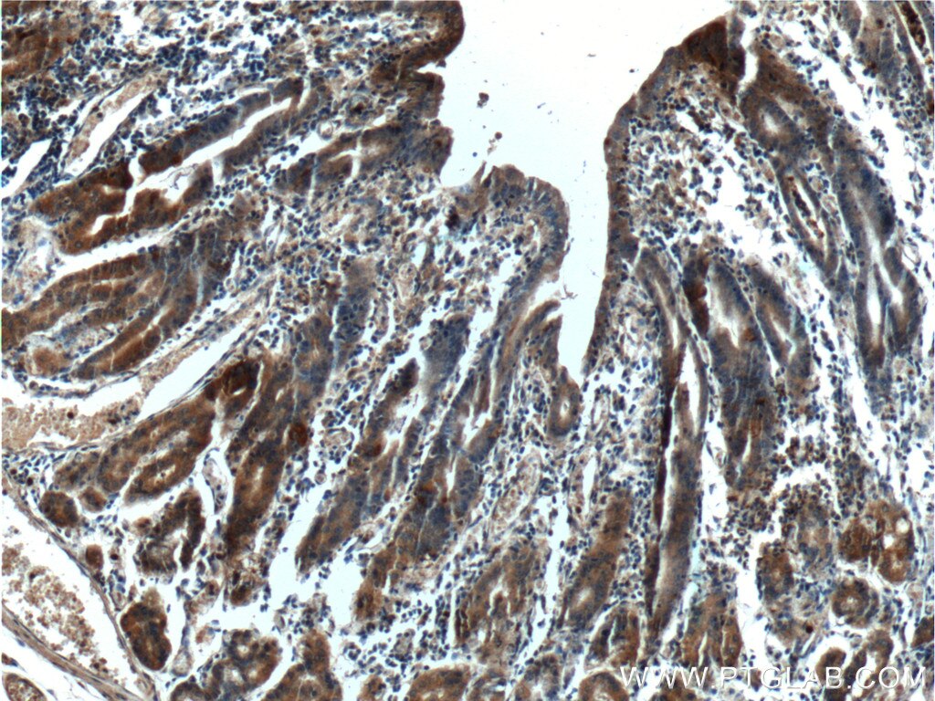 Immunohistochemistry (IHC) staining of human stomach tissue using LIPF Polyclonal antibody (25889-1-AP)