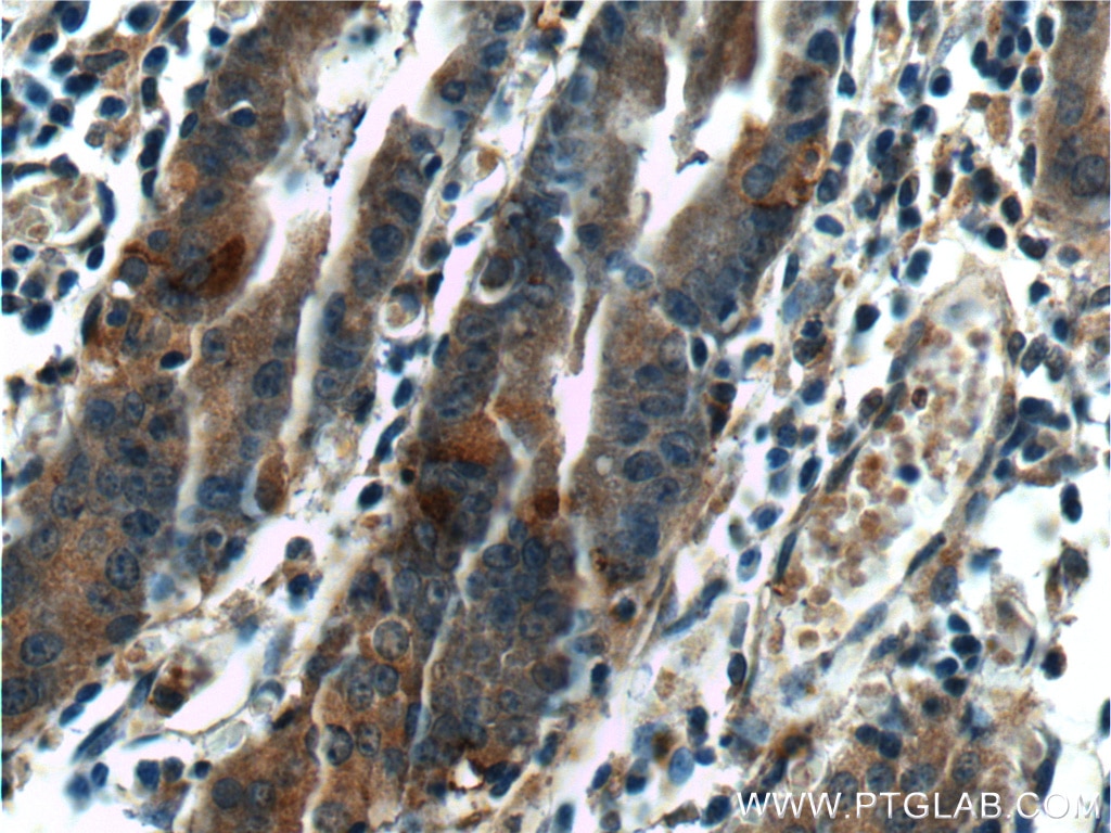 Immunohistochemistry (IHC) staining of human stomach tissue using LIPF Polyclonal antibody (25889-1-AP)