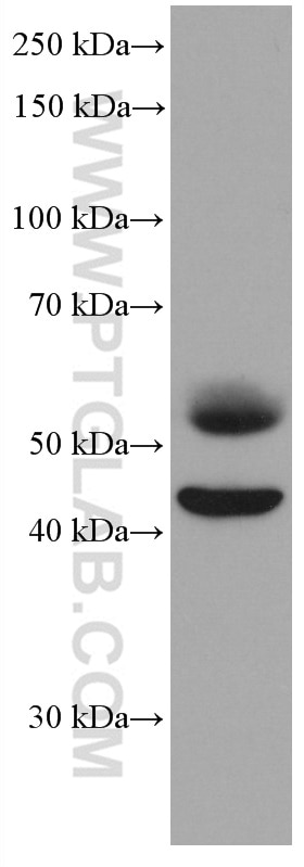 Western Blot (WB) analysis of human placenta tissue using LIPG Monoclonal antibody (67434-1-Ig)