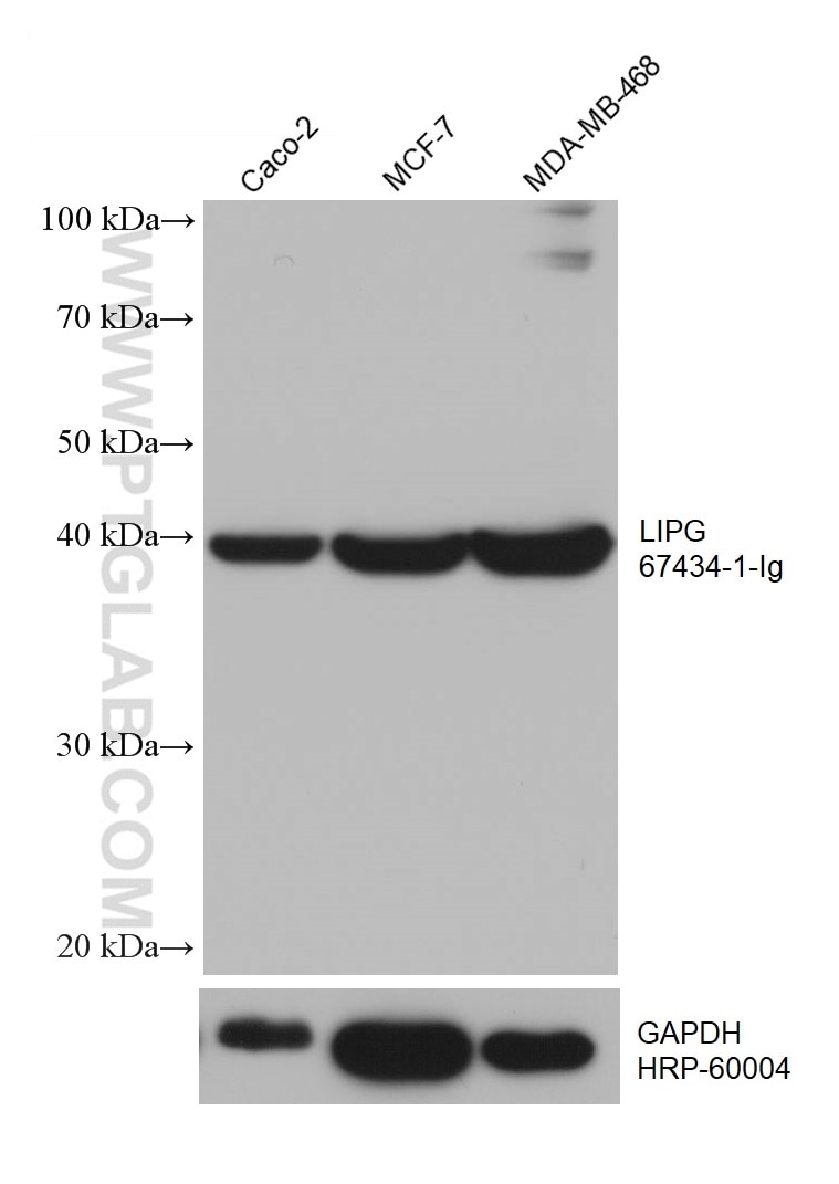 Western Blot (WB) analysis of various lysates using LIPG Monoclonal antibody (67434-1-Ig)