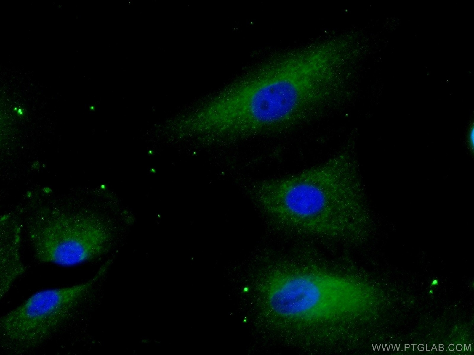 Immunofluorescence (IF) / fluorescent staining of A549 cells using LIPH Polyclonal antibody (16602-1-AP)
