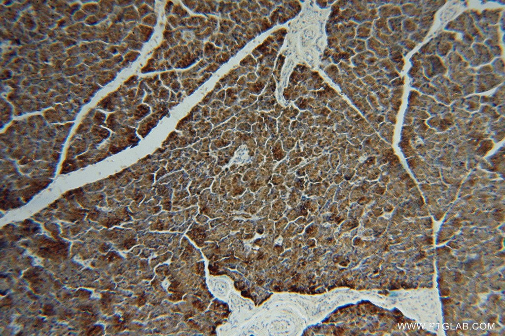 Immunohistochemistry (IHC) staining of human pancreas tissue using LIPH Polyclonal antibody (16602-1-AP)