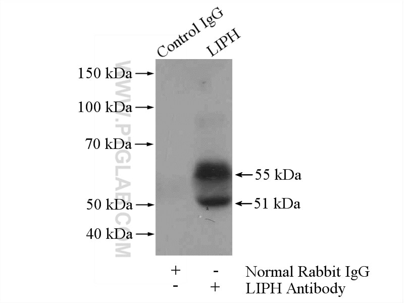 Immunoprecipitation (IP) experiment of mouse lung tissue using LIPH Polyclonal antibody (16602-1-AP)