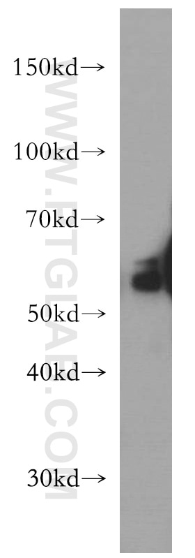 Western Blot (WB) analysis of COLO 320 cells using LIPH Polyclonal antibody (16602-1-AP)