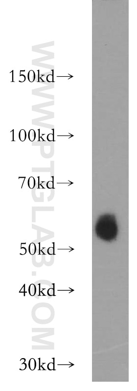 Western Blot (WB) analysis of A549 cells using LIPH Polyclonal antibody (16602-1-AP)
