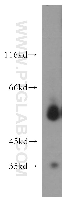 Western Blot (WB) analysis of mouse lung tissue using LIPH Polyclonal antibody (16602-1-AP)