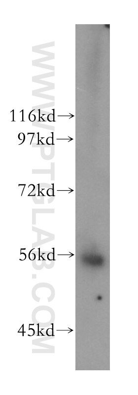 Western Blot (WB) analysis of A549 cells using LIPH Polyclonal antibody (16602-1-AP)