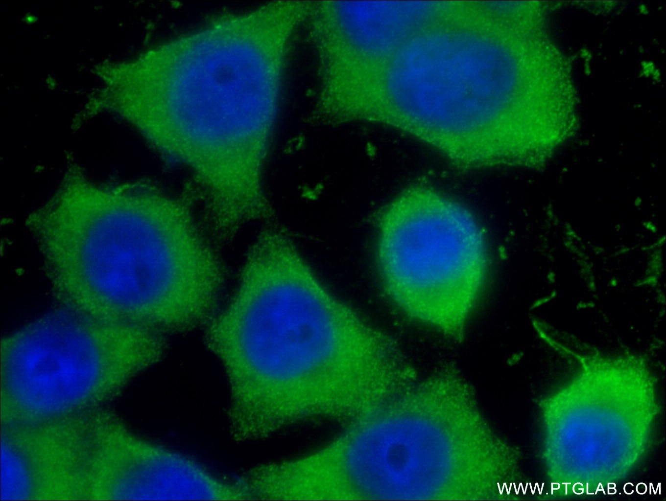 Immunofluorescence (IF) / fluorescent staining of BxPC-3 cells using LIPH Monoclonal antibody (66303-1-Ig)