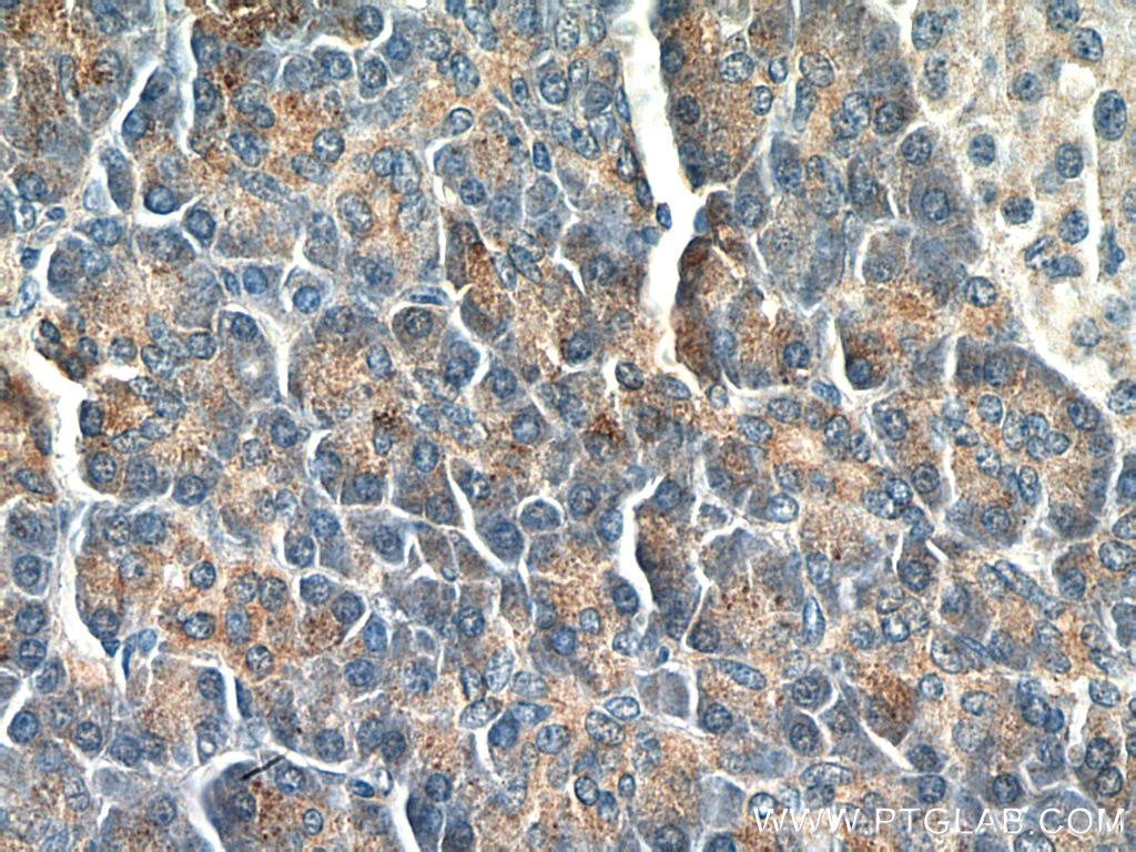 IHC staining of human pancreas using 66303-1-Ig