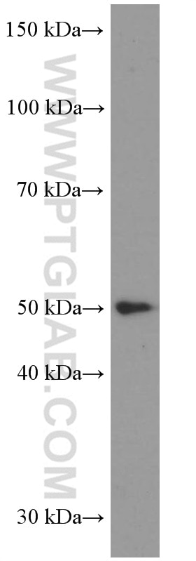 Western Blot (WB) analysis of SW 1990 cells using LIPH Monoclonal antibody (66303-1-Ig)