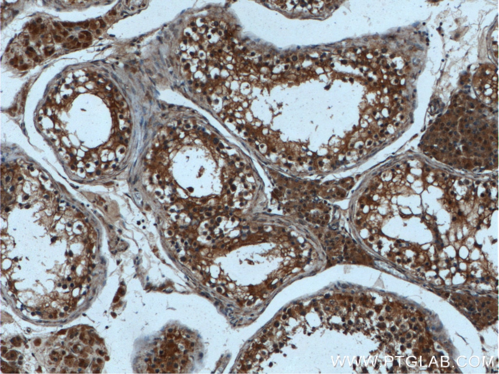 Immunohistochemistry (IHC) staining of human testis tissue using LIPI Polyclonal antibody (24300-1-AP)