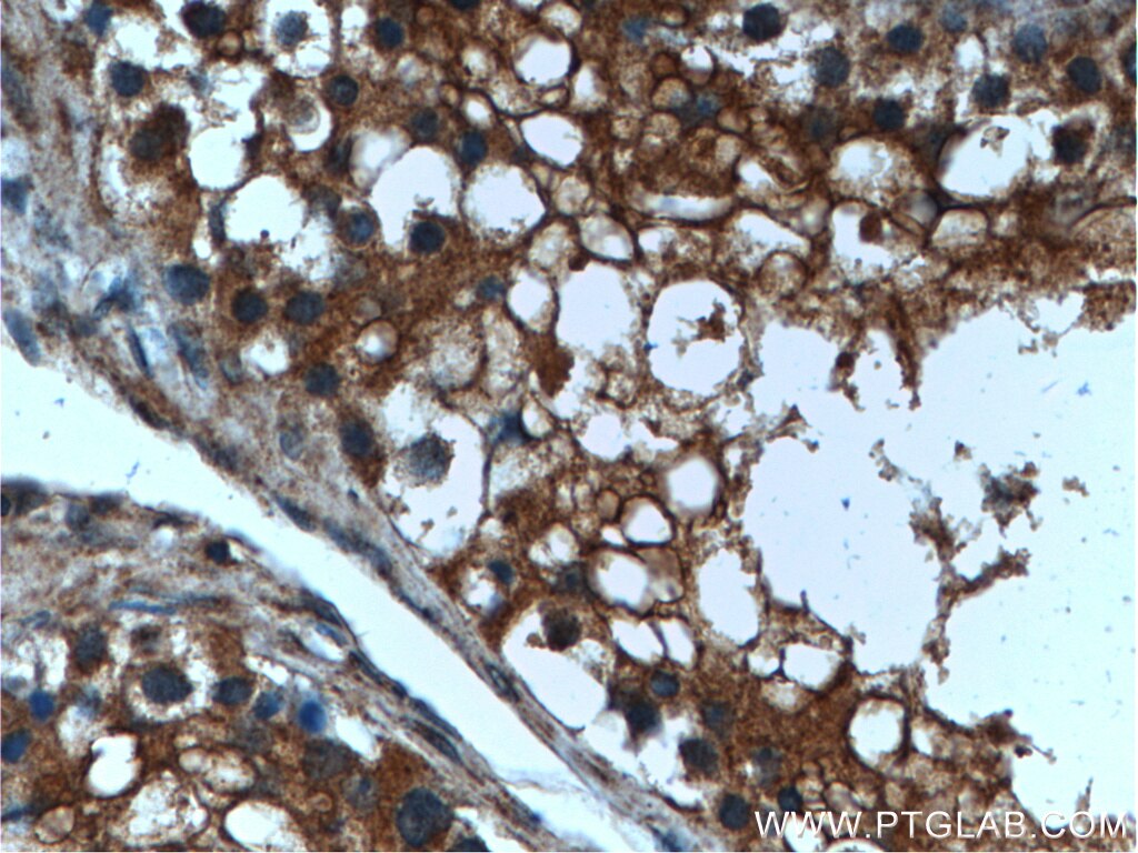 Immunohistochemistry (IHC) staining of human testis tissue using LIPI Polyclonal antibody (24300-1-AP)