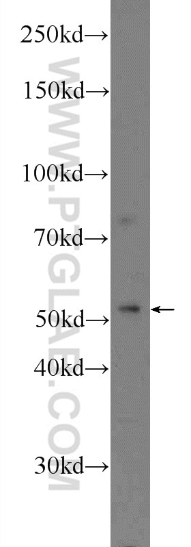 Western Blot (WB) analysis of A549 cells using LIPI Polyclonal antibody (24300-1-AP)