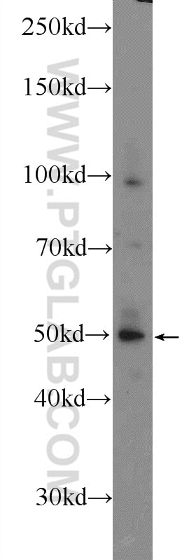 WB analysis of mouse lung using 24300-1-AP