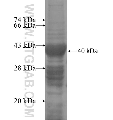 LIPJ fusion protein Ag15555 SDS-PAGE