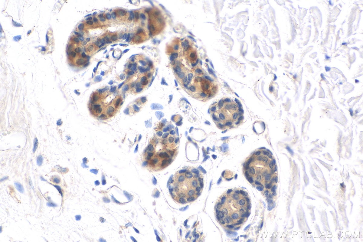 Immunohistochemistry (IHC) staining of human skin tissue using LIPM Polyclonal antibody (18817-1-AP)