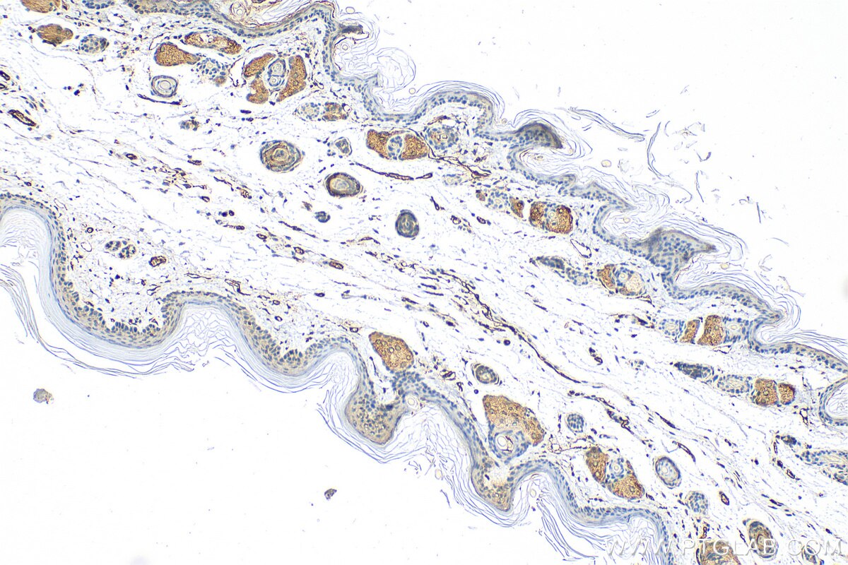 Immunohistochemistry (IHC) staining of mouse skin tissue using LIPM Polyclonal antibody (18817-1-AP)