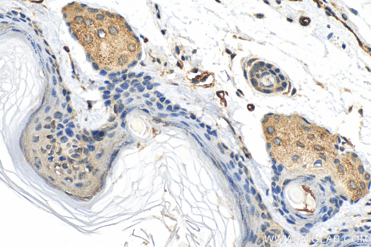 Immunohistochemistry (IHC) staining of mouse skin tissue using LIPM Polyclonal antibody (18817-1-AP)