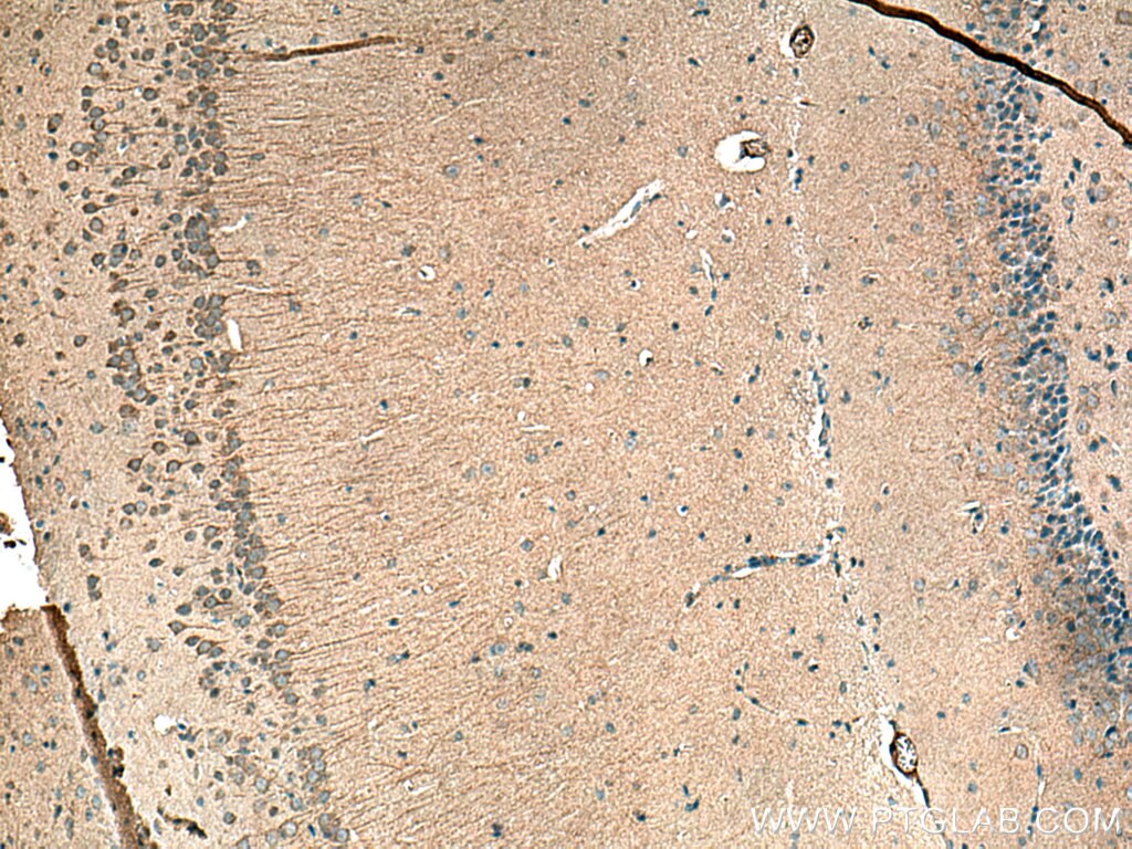 IHC staining of mouse brain using 20678-1-AP