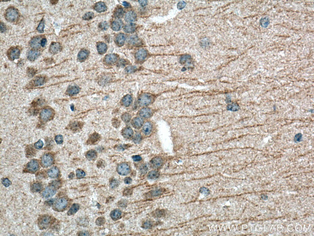 Immunohistochemistry (IHC) staining of mouse brain tissue using LIS1 Polyclonal antibody (20678-1-AP)