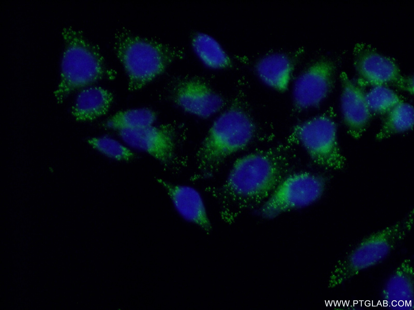 Immunofluorescence (IF) / fluorescent staining of HepG2 cells using LITAF Polyclonal antibody (16797-1-AP)