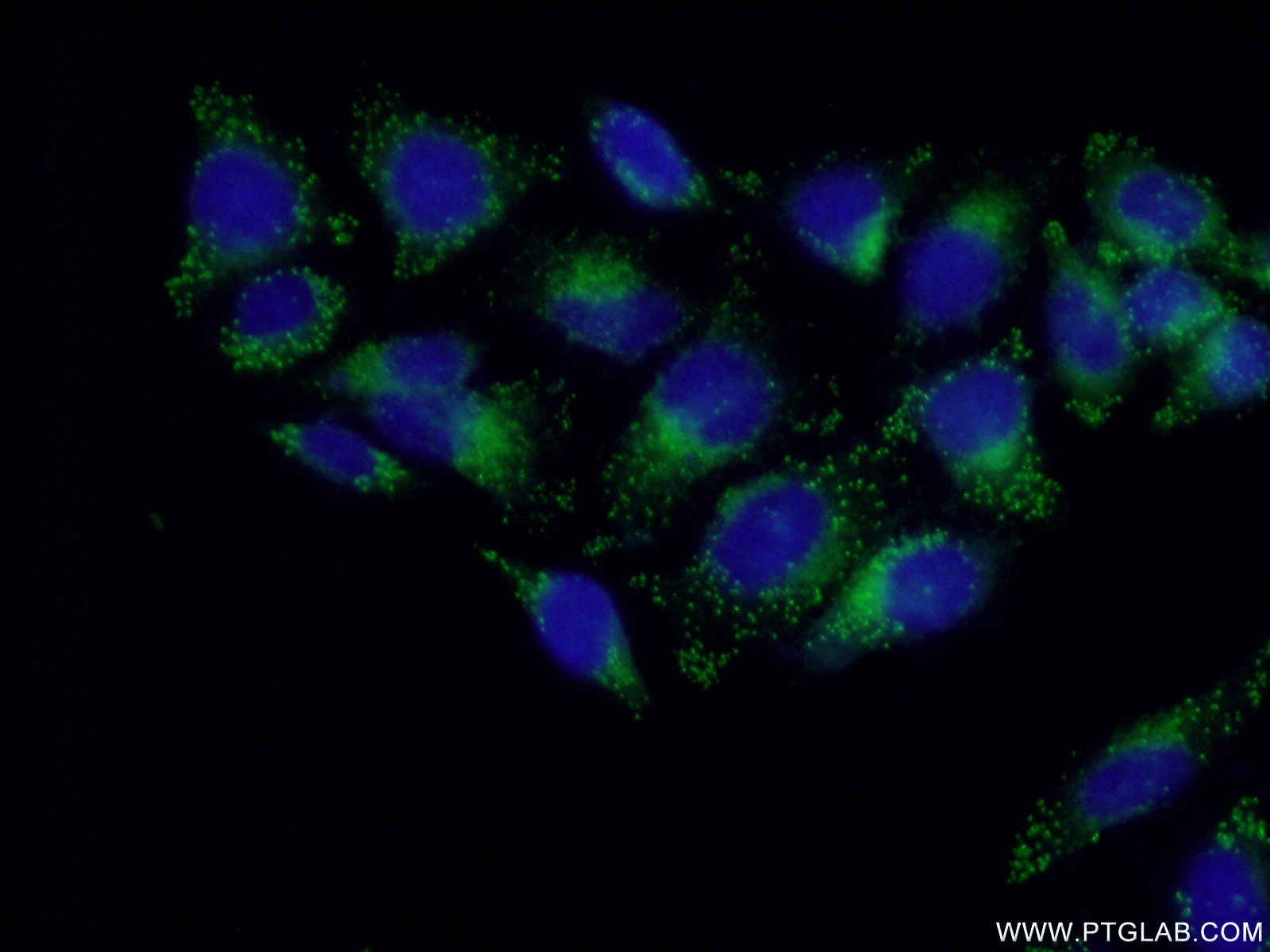 IF Staining of HepG2 using 16797-1-AP