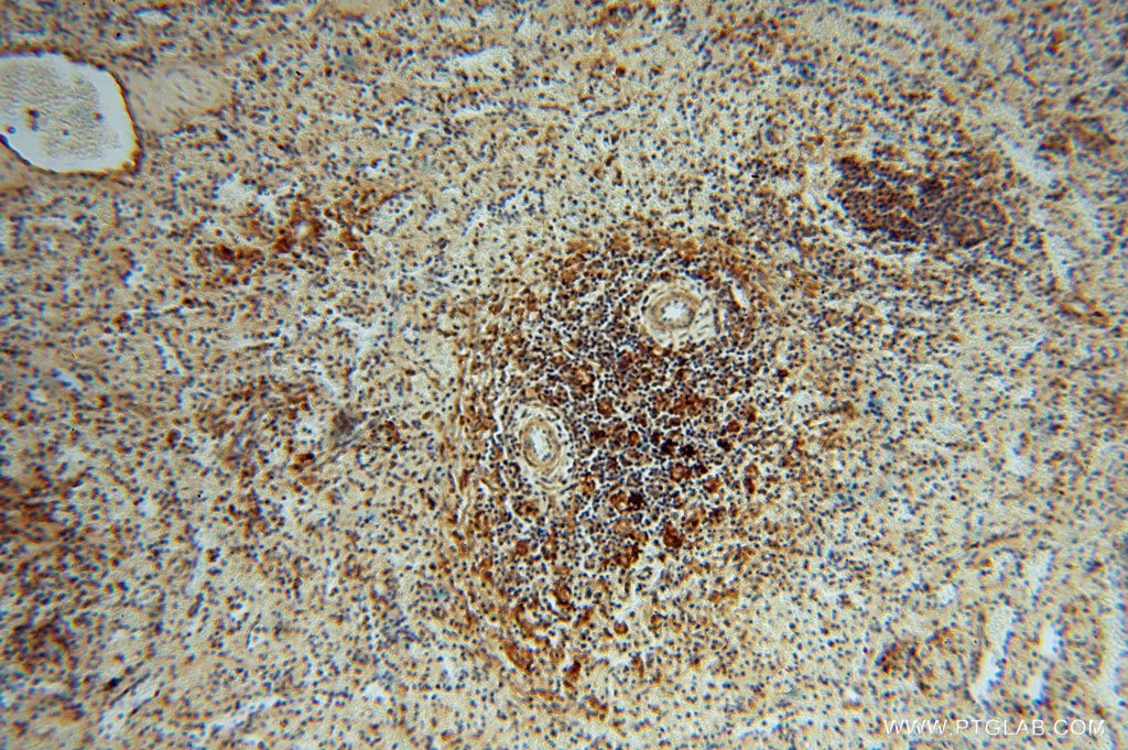 Immunohistochemistry (IHC) staining of human spleen tissue using LITAF Polyclonal antibody (16797-1-AP)