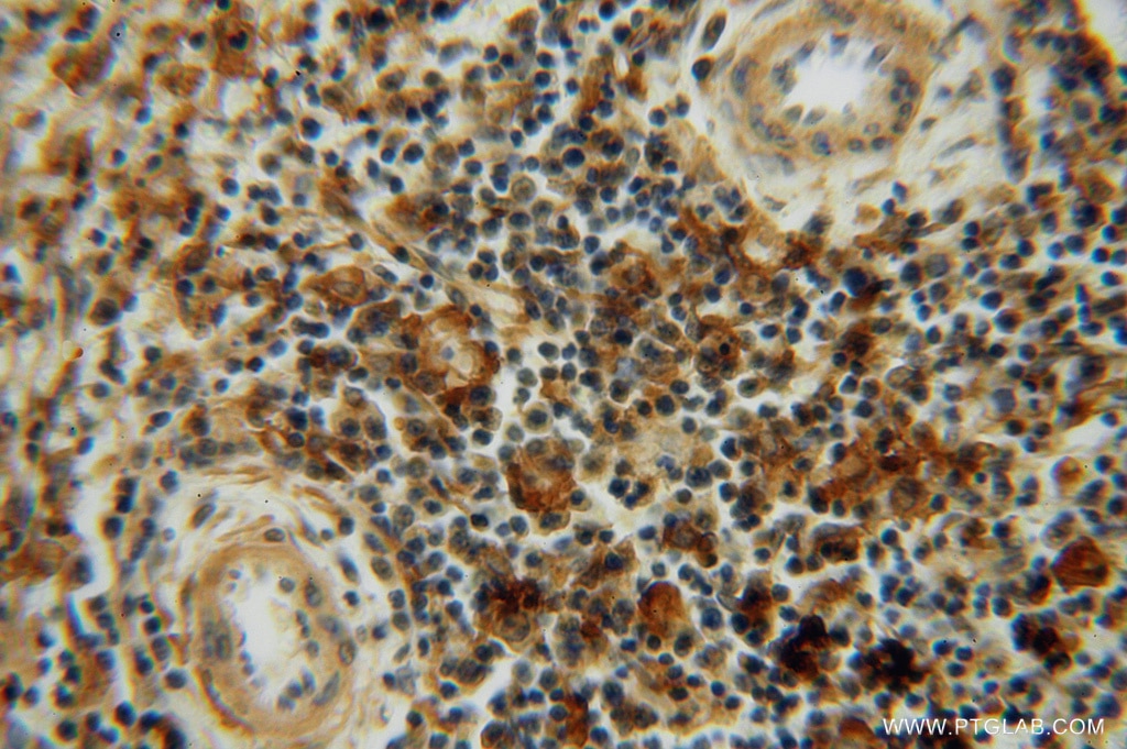 Immunohistochemistry (IHC) staining of human spleen tissue using LITAF Polyclonal antibody (16797-1-AP)