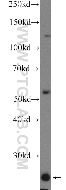 Western Blot (WB) analysis of HeLa cells using LITAF Polyclonal antibody (16797-1-AP)