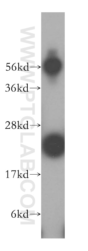 Western Blot (WB) analysis of HeLa cells using LITAF Polyclonal antibody (16797-1-AP)