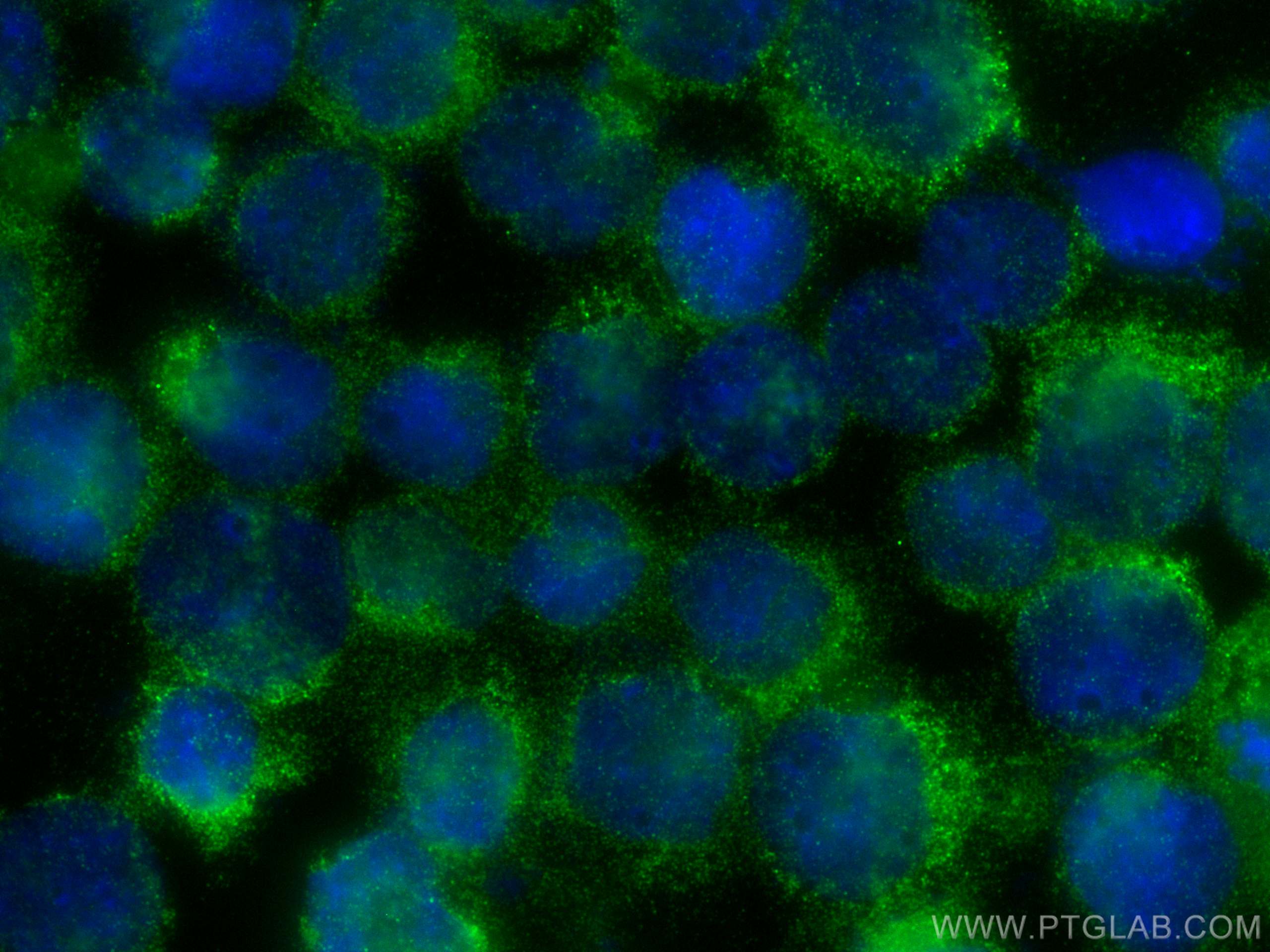 Immunofluorescence (IF) / fluorescent staining of K-562 cells using LIX1L Polyclonal antibody (25557-1-AP)