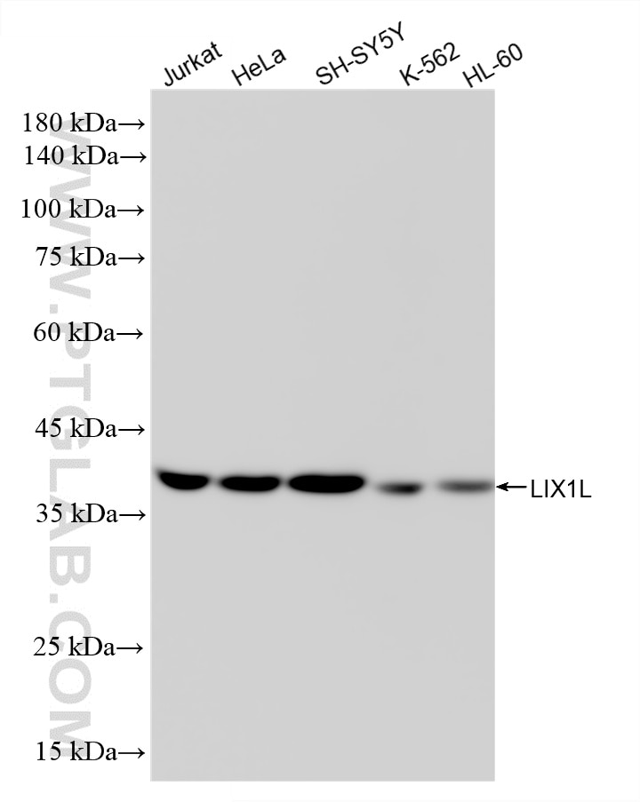 Western Blot (WB) analysis of various lysates using LIX1L Recombinant monoclonal antibody (86712-3-RR)