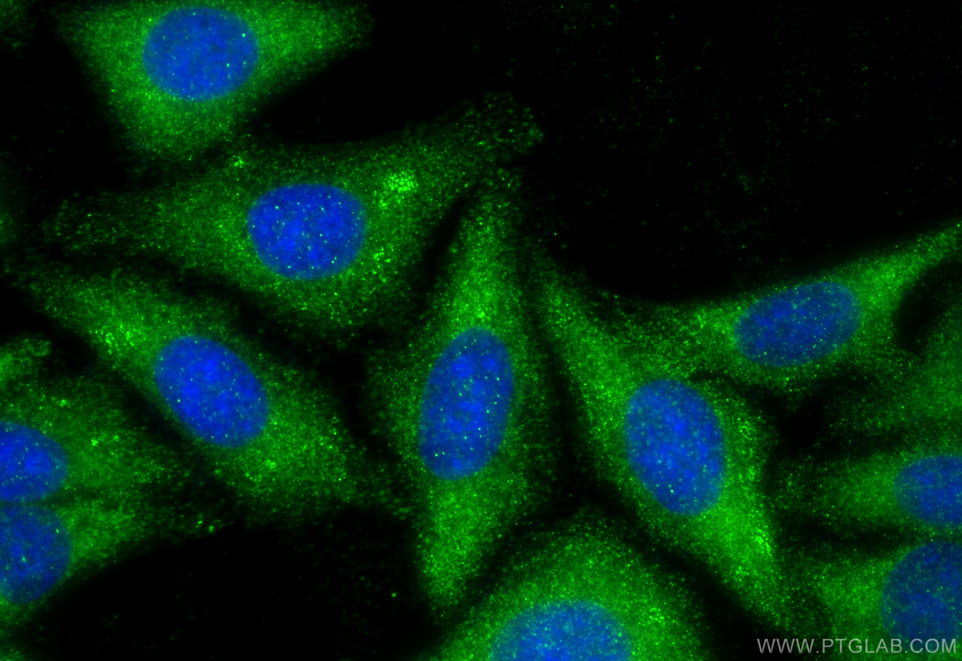 Immunofluorescence (IF) / fluorescent staining of HepG2 cells using LLGL1 Polyclonal antibody (22496-1-AP)