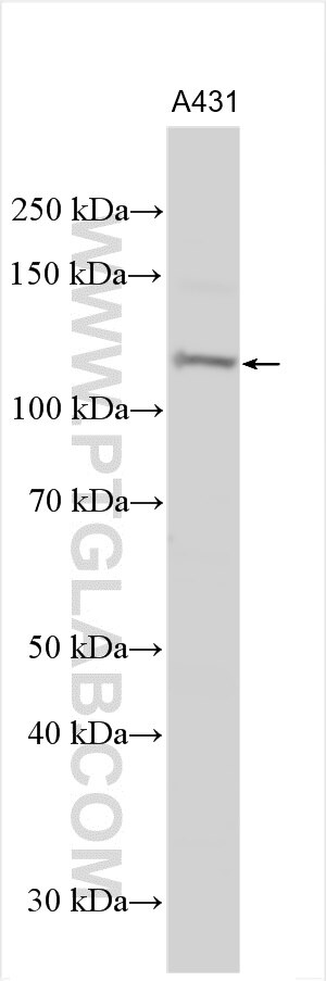 Western Blot (WB) analysis of various lysates using LLGL1 Polyclonal antibody (22496-1-AP)