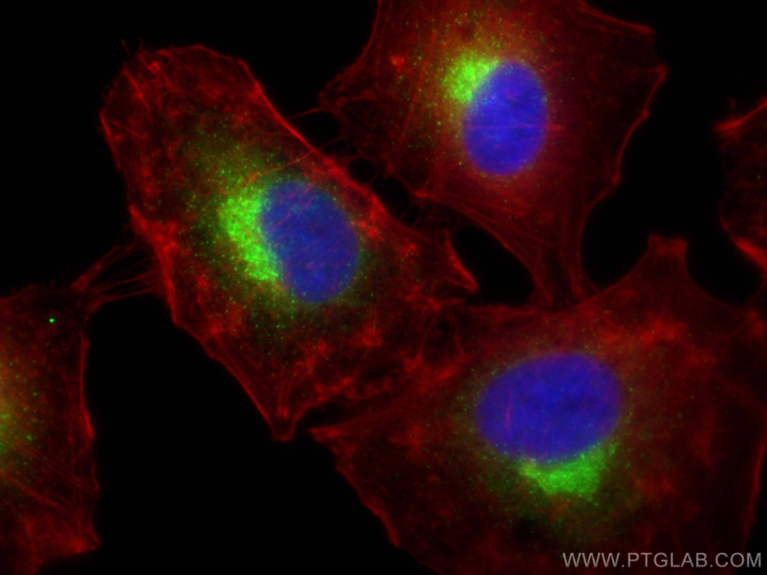 Immunofluorescence (IF) / fluorescent staining of A549 cells using ERGIC-53 Polyclonal antibody (13364-1-AP)