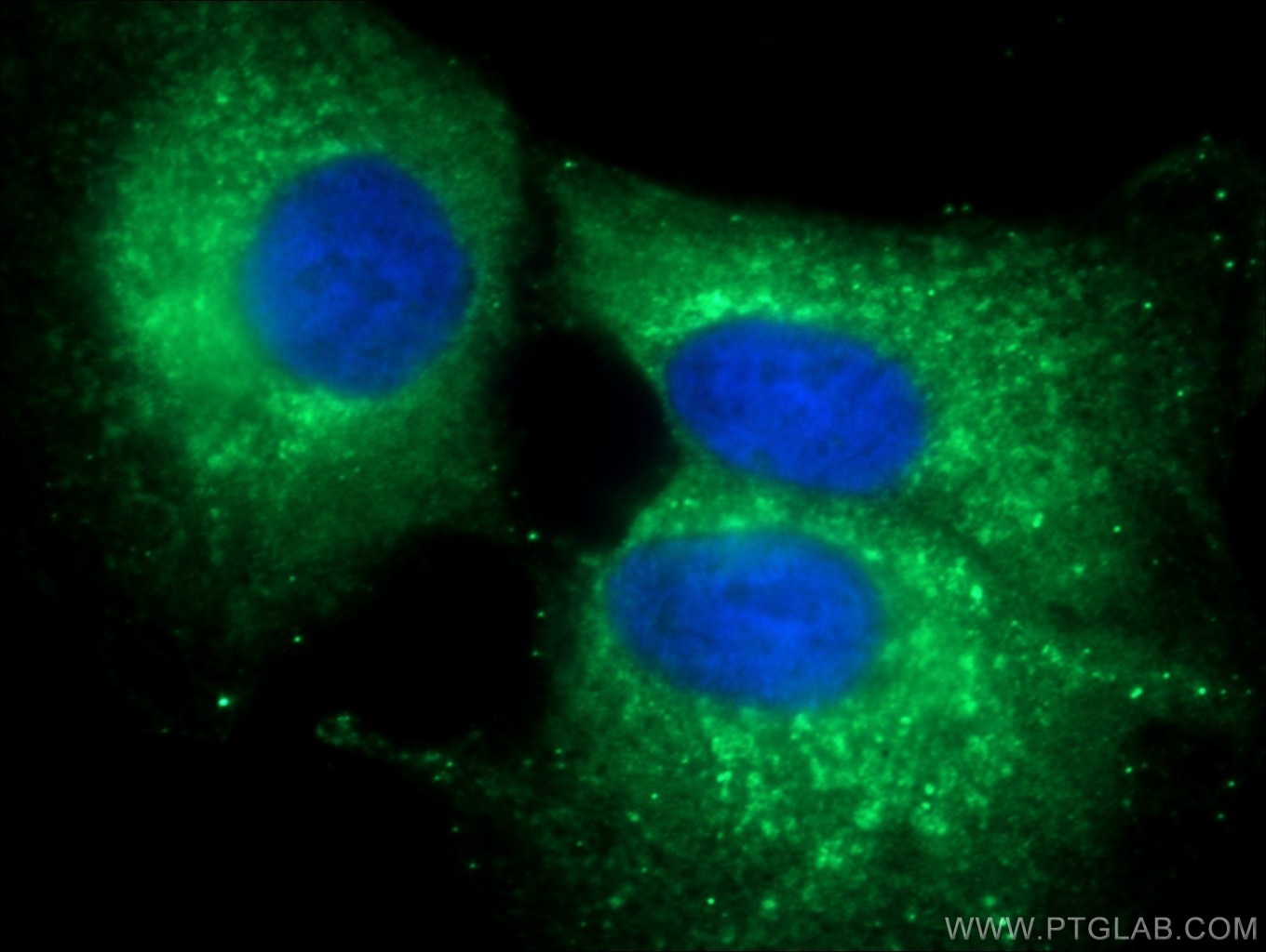 Immunofluorescence (IF) / fluorescent staining of A549 cells using ERGIC-53 Polyclonal antibody (13364-1-AP)