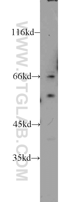 Western Blot (WB) analysis of mouse brain tissue using ERGIC-53 Polyclonal antibody (13364-1-AP)