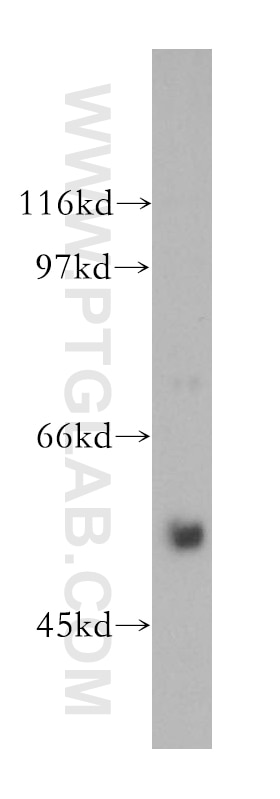 Western Blot (WB) analysis of human brain tissue using ERGIC-53 Polyclonal antibody (13364-1-AP)