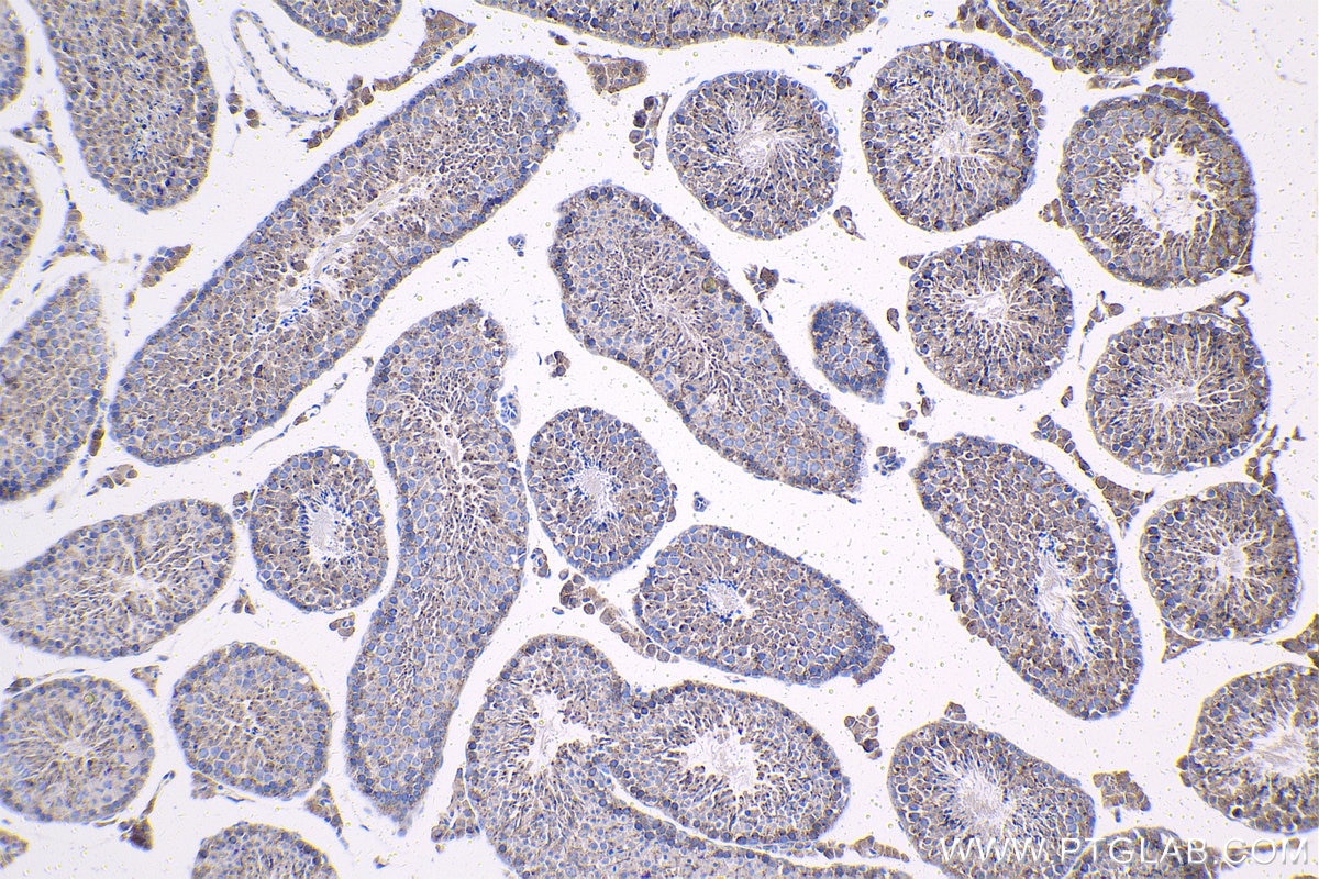 Immunohistochemistry (IHC) staining of mouse testis tissue using LMAN2 Polyclonal antibody (11496-1-AP)