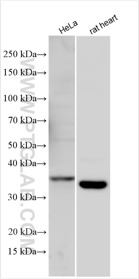 Western Blot (WB) analysis of various lysates using LMAN2 Polyclonal antibody (11496-1-AP)