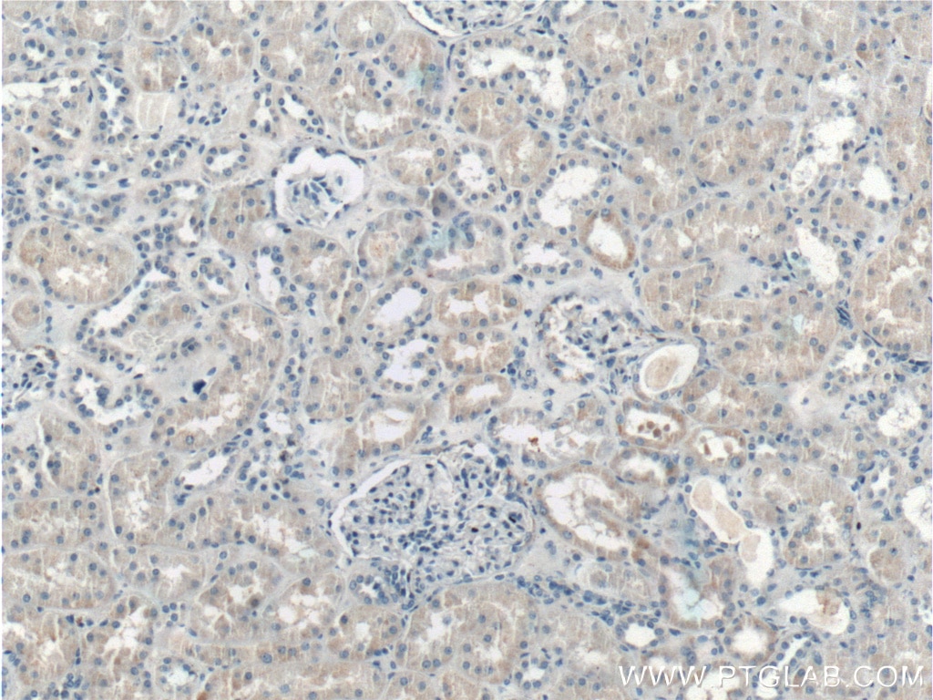 Immunohistochemistry (IHC) staining of human kidney tissue using LMAN2L Polyclonal antibody (17877-1-AP)