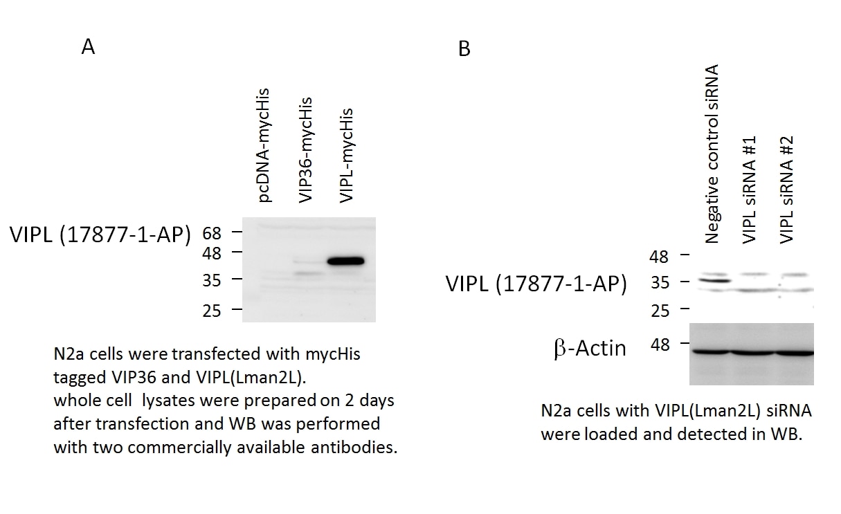 Western Blot (WB) analysis of N2a cells using LMAN2L Polyclonal antibody (17877-1-AP)