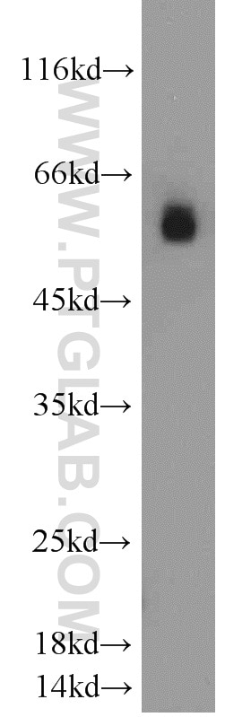 WB analysis of A549 using 12154-1-AP