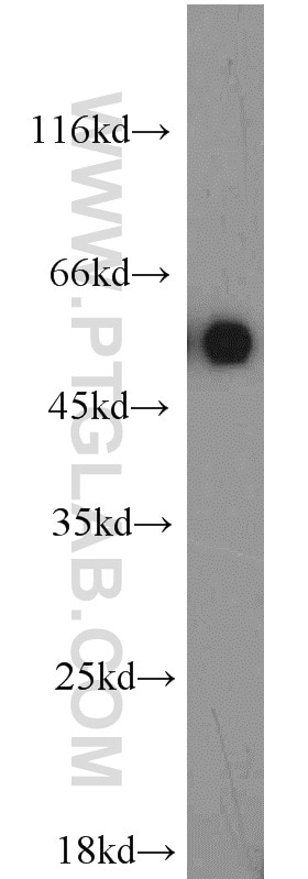 Western Blot (WB) analysis of mouse testis tissue using LMBR1L Polyclonal antibody (12154-1-AP)