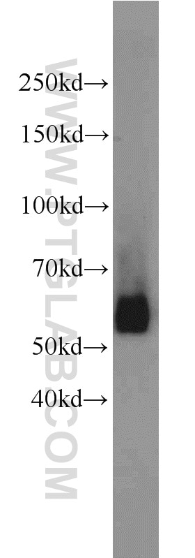 Western Blot (WB) analysis of rat testis tissue using LMBR1L Polyclonal antibody (12154-1-AP)