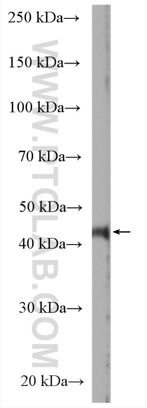 Western Blot (WB) analysis of mouse small intestine tissue using LMBRD1 Polyclonal antibody (27203-1-AP)